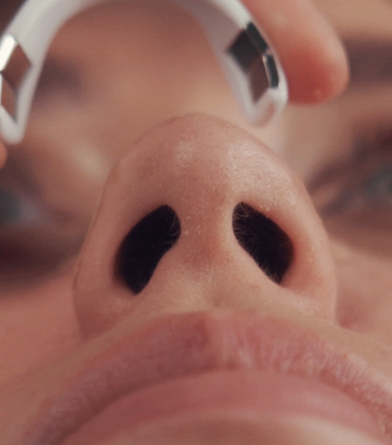 Nose Strips